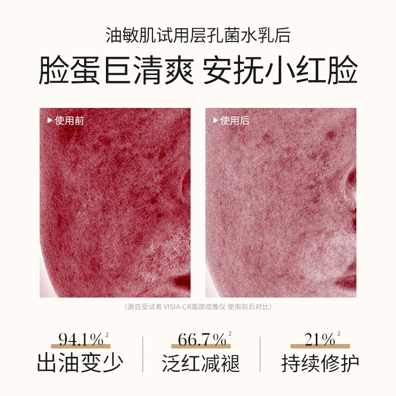 溪木源层孔菌控油舒敏精华水中乳洁颜蜜套装ZB pp