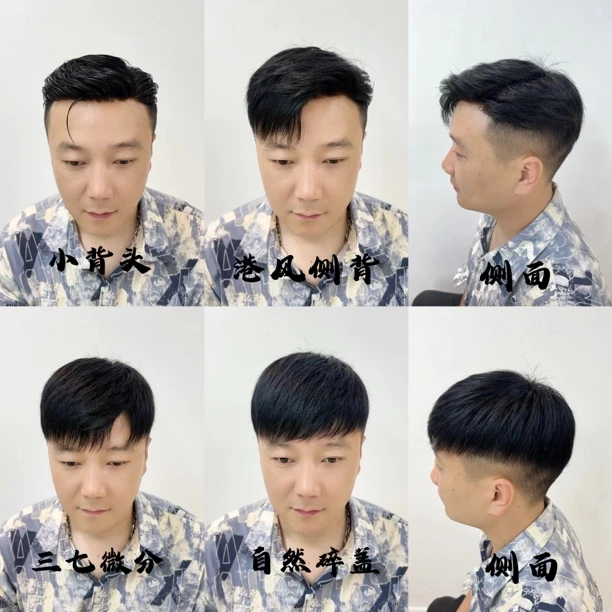德国纱双递针工艺男士持久真人发丝头顶补发透气工厂直销销量领先