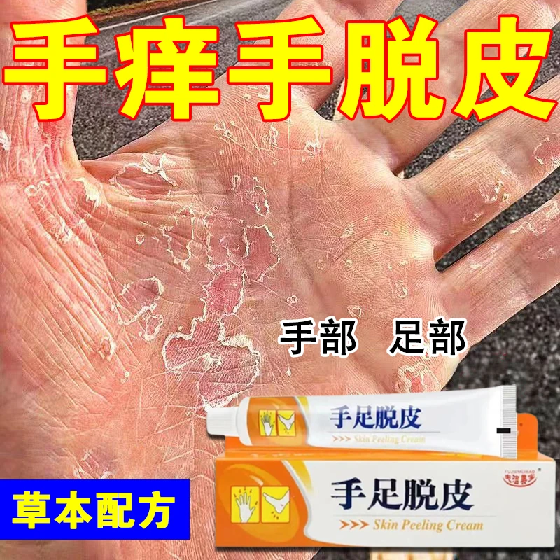 夫洁美宝手足脱皮膏 25g/盒 草本萃取温和大人小孩通用 手脚脱皮