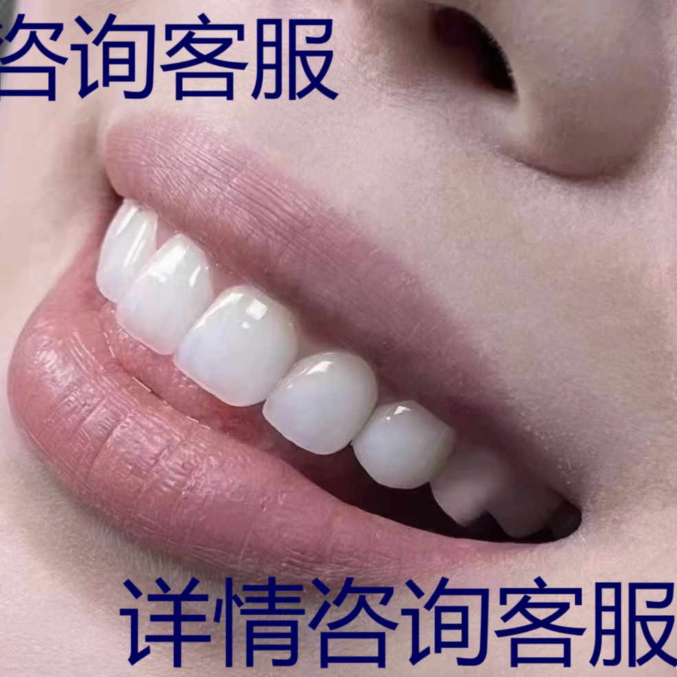 【咨询主播】各种牙贴 拉萨 山南 林芝 日喀则 亚东可咨询