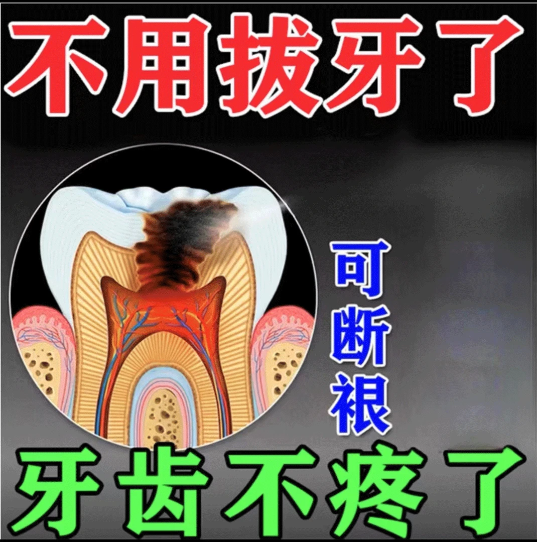牙疼神器】牙神经疼虫牙蛀牙上火红肿牙齿敏感快速止疼口腔喷剂