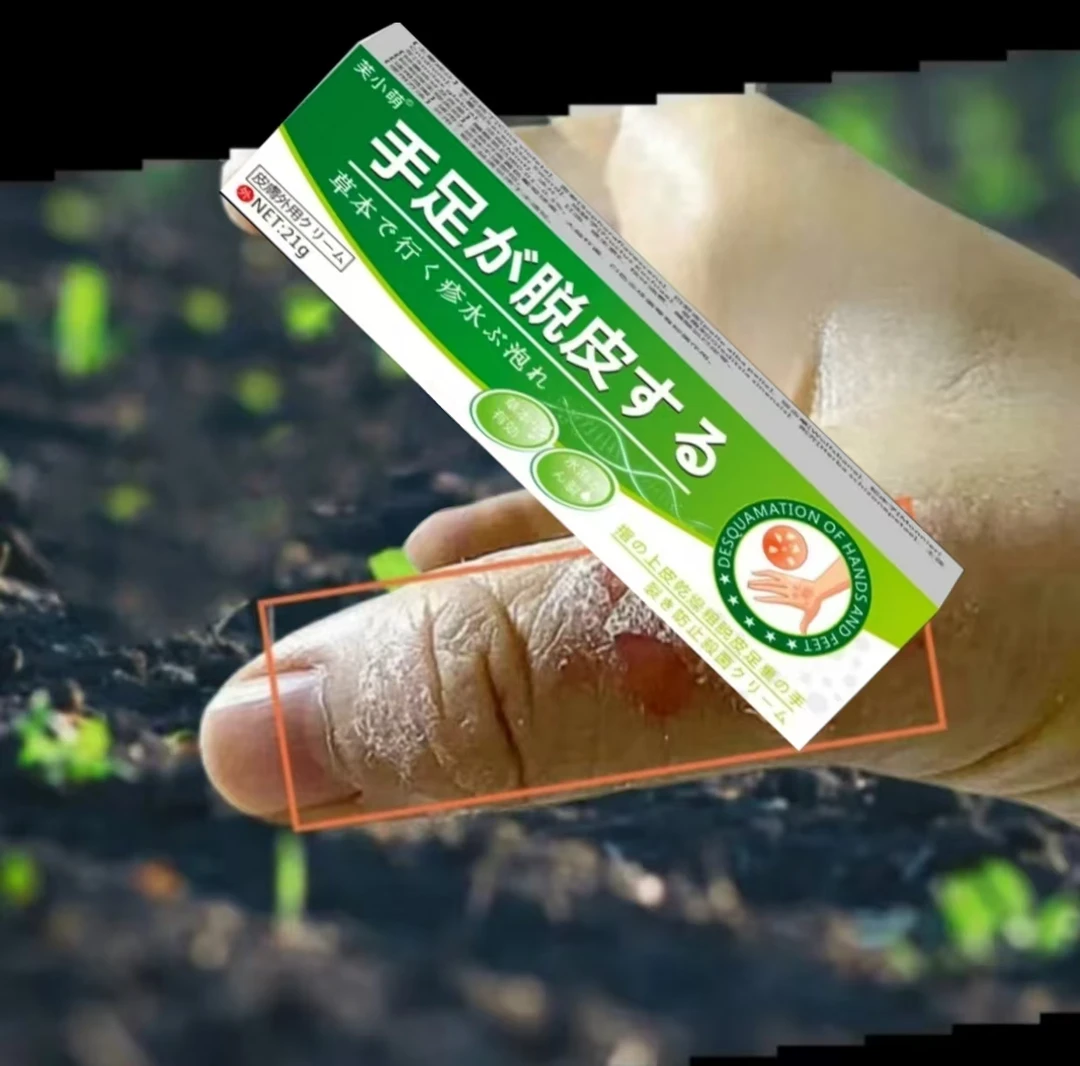 手足脱皮膏脚后跟皴裂膏干裂龟裂膏护手护足霜