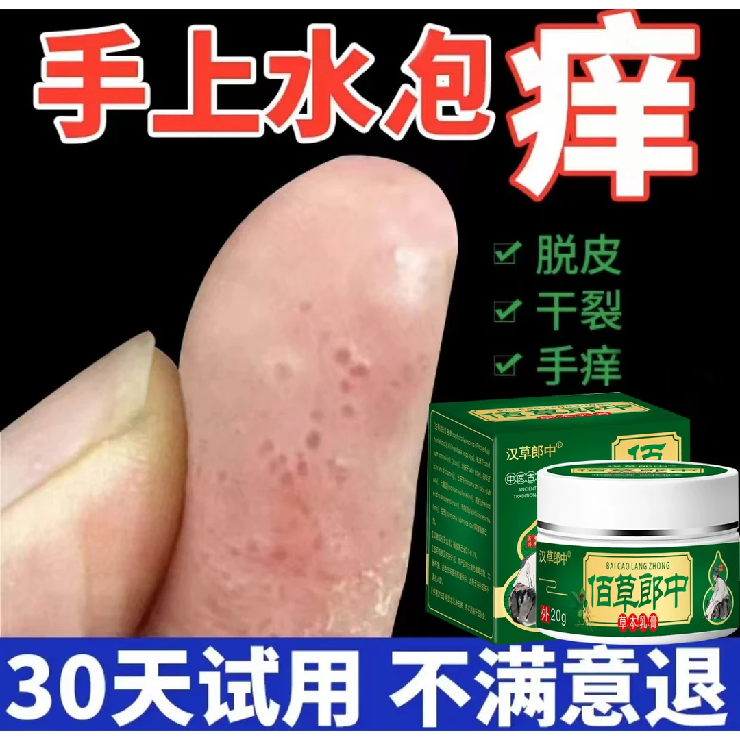皮肤痒手脚痒大腿内侧痒全身皮肤外用抑菌止痒膏