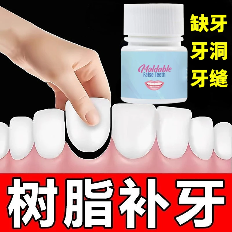 20ml装牙洞填补膏蛀牙修复快速堵缺牙补牙神器自己补牙齿膏补牙缝