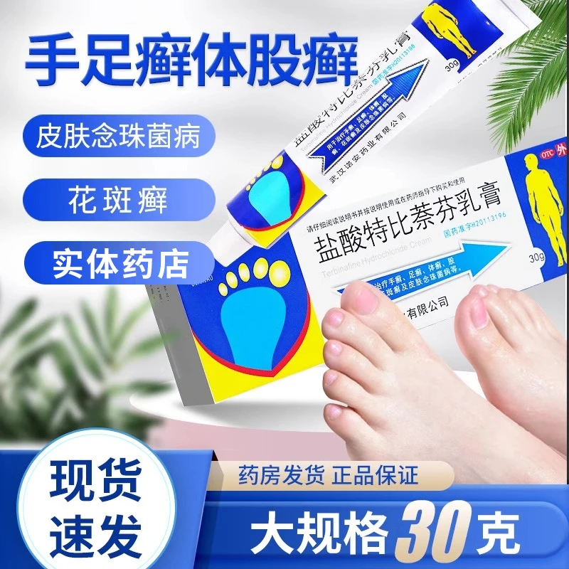 嘉效盐酸特比萘芬乳膏1%*30g足癣皮肤用药手足癣体股癣花斑癣皮肤念珠菌病正品