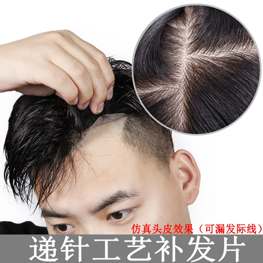 （全递针）男士假发补发片假发块卡子胶片真发假发男补发秃顶假发