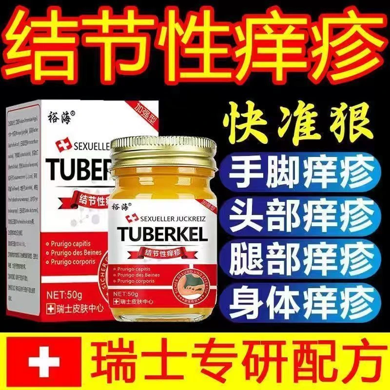 结节性痒疹止痒特效进口去硬疙瘩结咔苔癣皮焱顽固型慢性用品