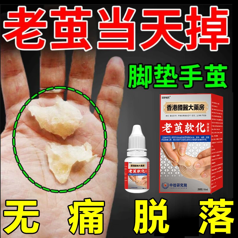 脚上老茧软化液手茧脚茧脚底硬茧小脚趾脚后跟厚茧老茧手茧子外用
