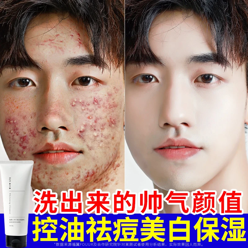 福翼洗面奶女男士专用美白祛痘去黑头清洁收缩毛孔正品控油洁面乳