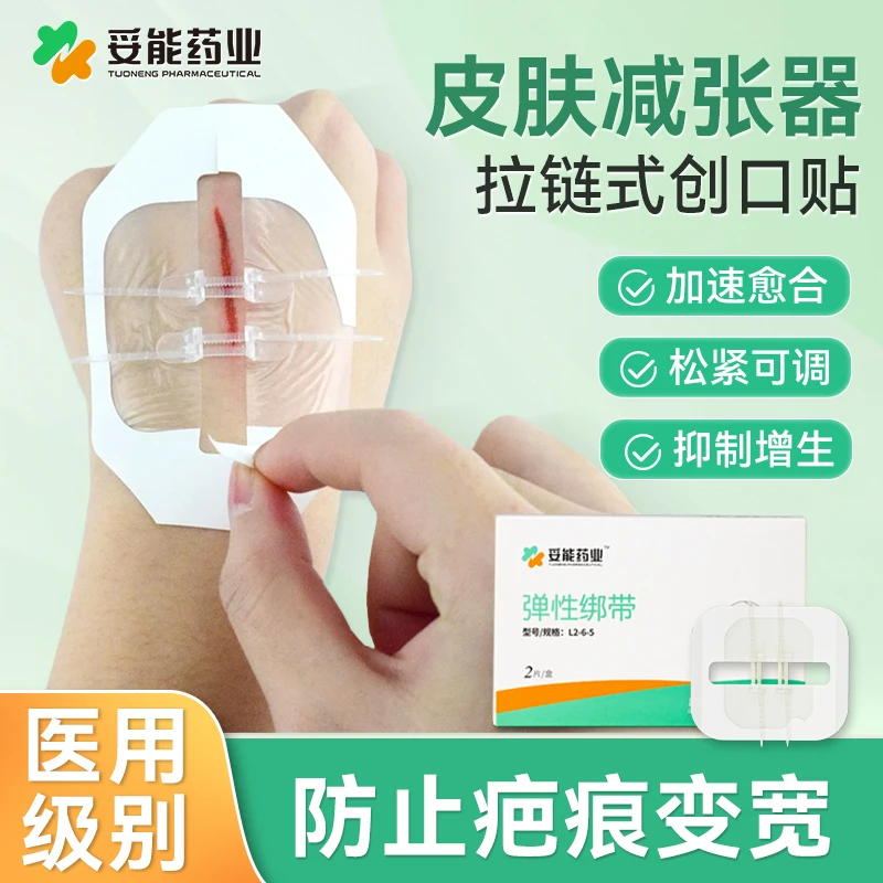 妥能药业皮肤减张器拉链式创可贴医用弹性绑带儿童成人疤痕伤口防变宽
