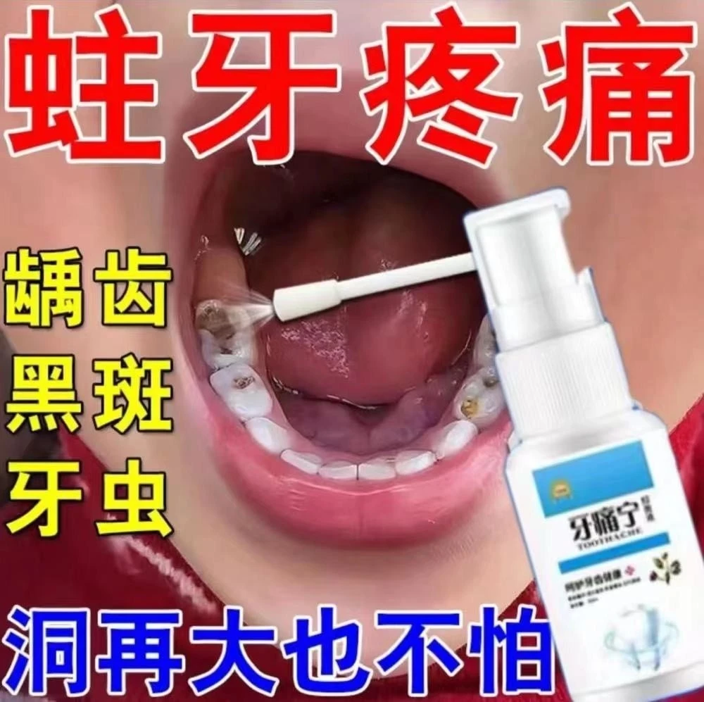 杀死牙神经牙痛智齿上火蛀牙虫牙杀死牙神经牙疼牙痛专用抑菌喷剂