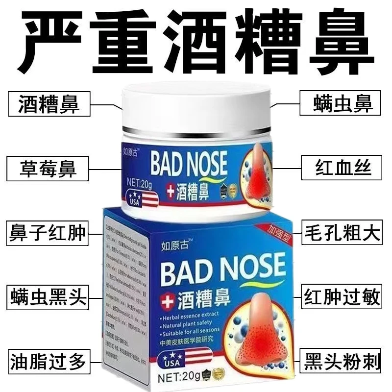 正品酒渣鼻红鼻子螨虫鼻去鼻头大鼻子粉刺红血丝草莓鼻专用特效膏