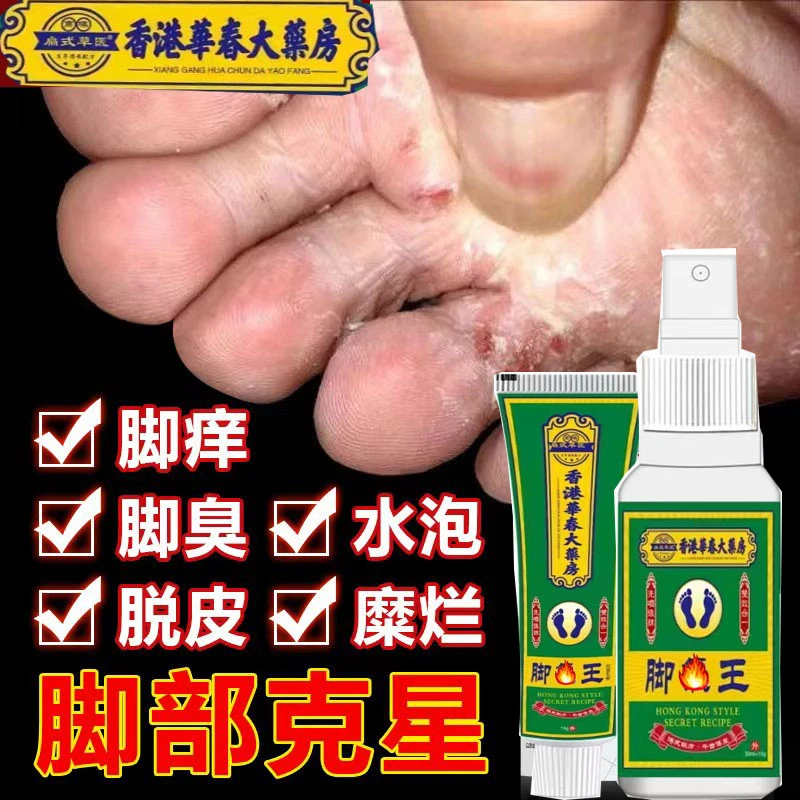 【支持试用】脚趾缝烂痒专用脚痒脚臭止痒神器脚丫脱皮抑菌开裂克星