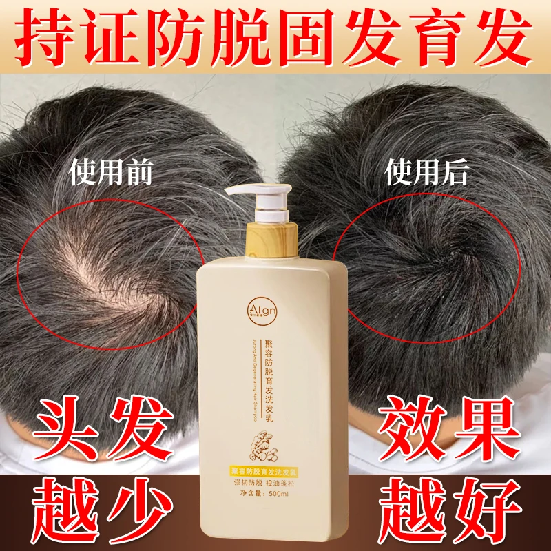 生姜洗发水防脱固发育发控油去头屑止痒乳液男女士官方旗舰店正品