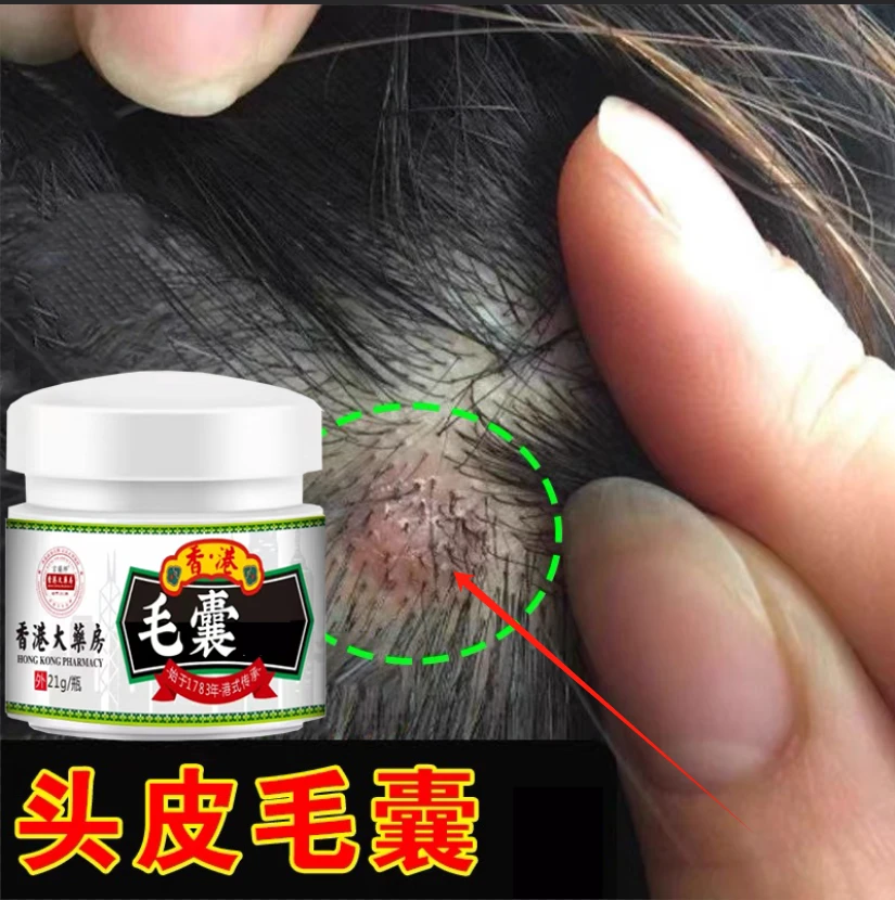 头上有疙瘩痘痘专用毛囊堵塞头皮发痒红肿坑坑洼洼毛囊净膏通用