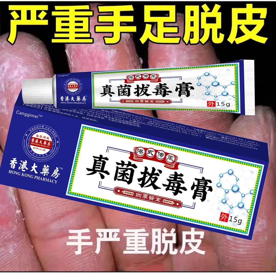 手脱皮手足软膏手痒手脱皮皮肤干燥起皮脱皮手脚脱皮护理软膏