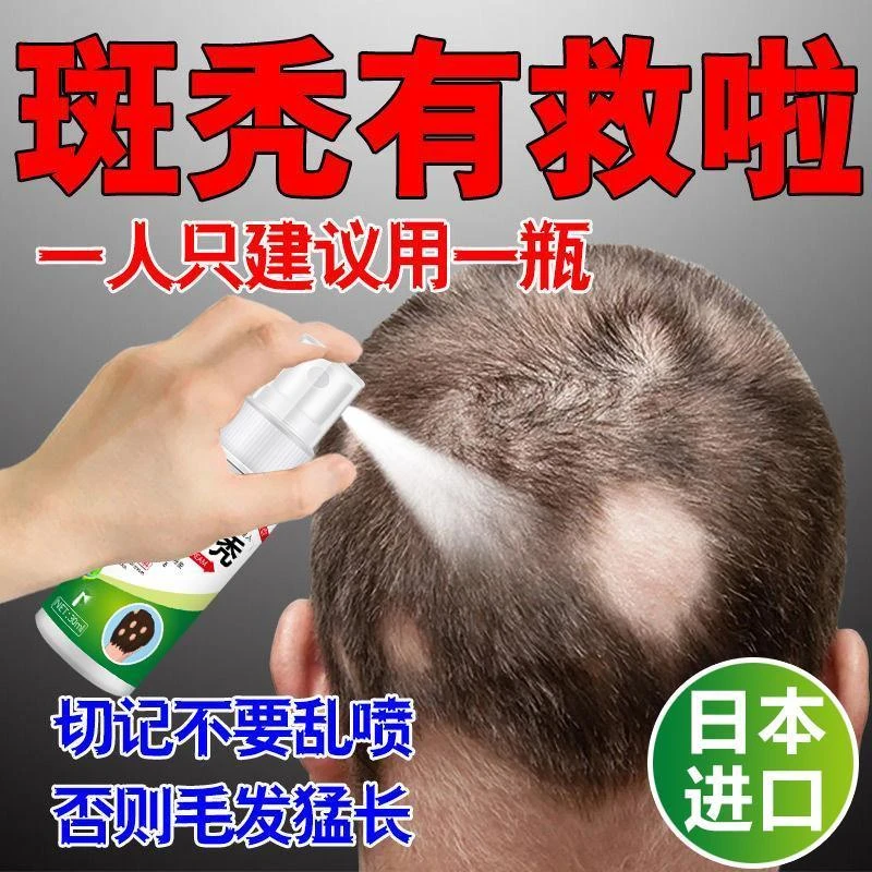 鬼剃头专用膏严重突发性掉头发斑秃脂溢性皮焱植物防脱持久护理