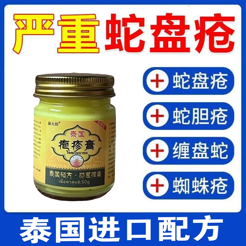 带状泡疹后遗症神经痛蛇盘疮膏蛇盘清宝缠腰龙生直器疱专用外用膏