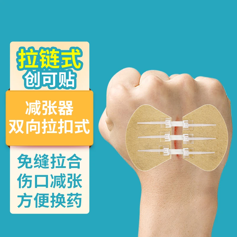 捷真医用拉合型绷带减张贴2扣3扣免缝针胶带伤口缝合减张器拉链式创可贴无痛缝合贴