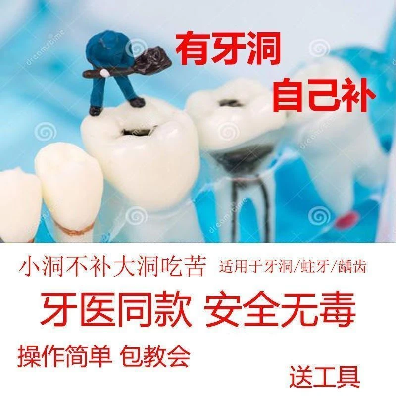 自己动手补牙齿补牙洞修补牙齿填充牢固方便快捷新型材料送工具