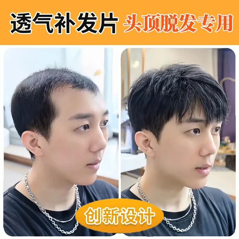 新款男士假发遮盖头顶男式假发片隐形自然可粘可卡全真发假发男生