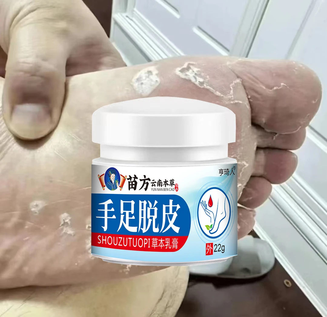 脚后跟干裂粗糙脚底起皮脚痒脚后跟脱皮脚臭抑菌止痒软膏