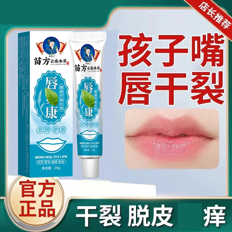 唇炎膏专用修复嘴唇口周干裂脱皮红痒上火烂嘴角开裂保湿滋润唇膏
