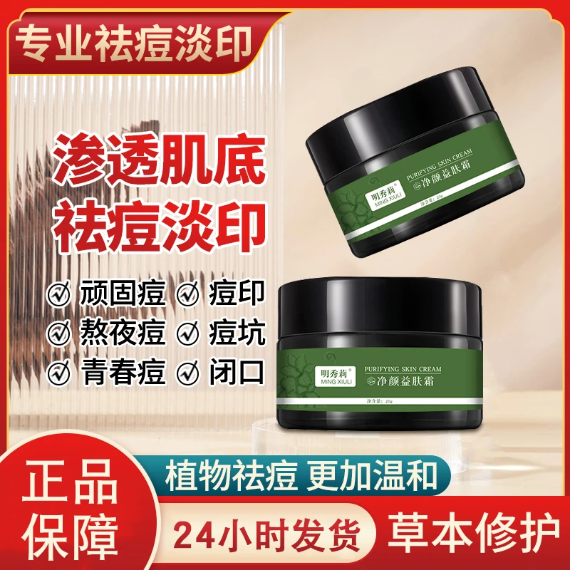 【草本祛痘闭口】专业祛痘净颜霜祛痘闭口粉刺淡化痘印痘坑背部祛痘