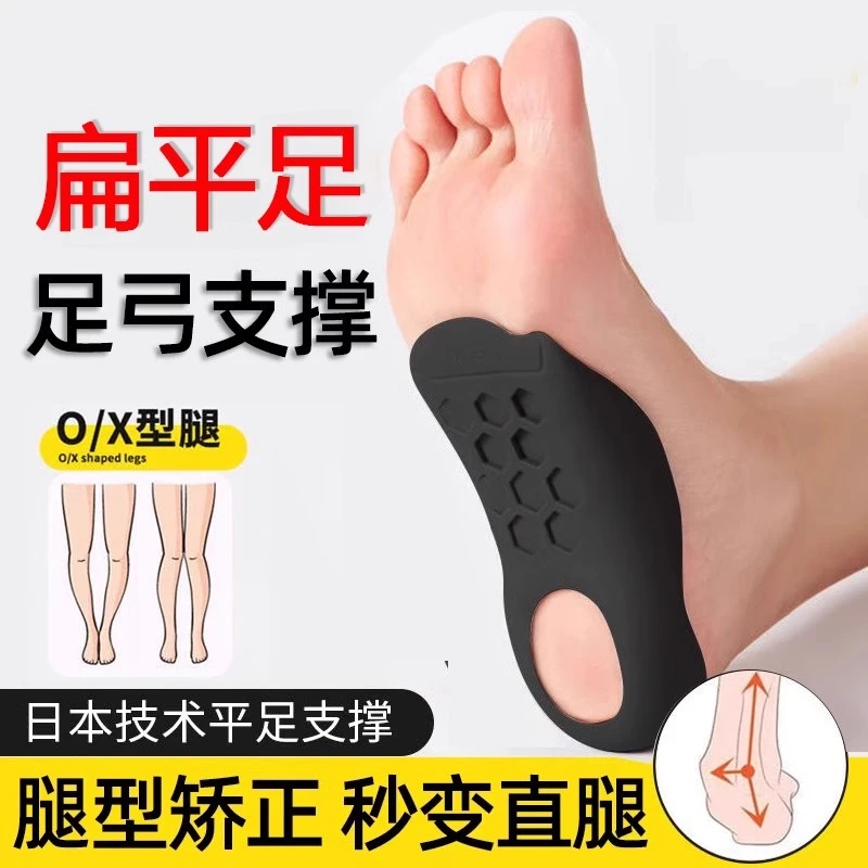 女士足弓垫扁平足弓支撑鞋垫小腿外翻足内翻xo形腿扁平足矫正脚垫