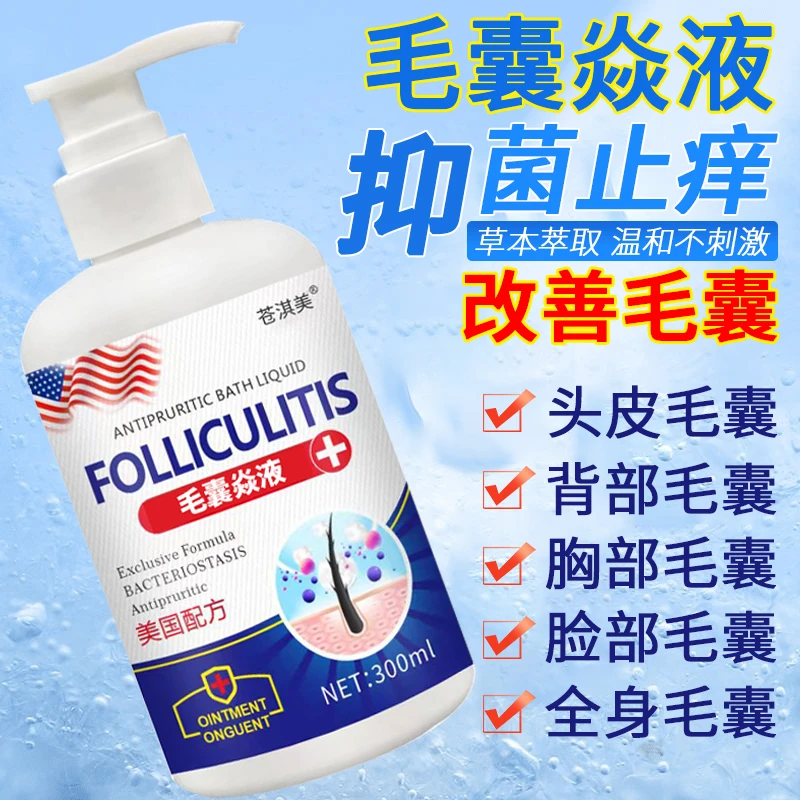 毛囊专用洗液头皮头部长红疙瘩痘痘抑菌止痒洗澡洗发水二合一洗剂