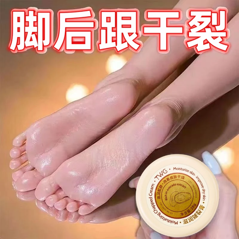 脚后跟干裂起硬皮身体手足霜皲裂膏保湿霜防干防裂手足粗糙润足跟
