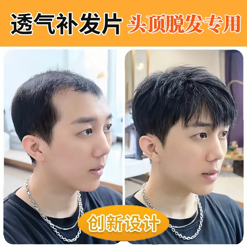 假发男短发毛寸男士头顶补发片全真人发丝可粘可卡隐形无痕假发片