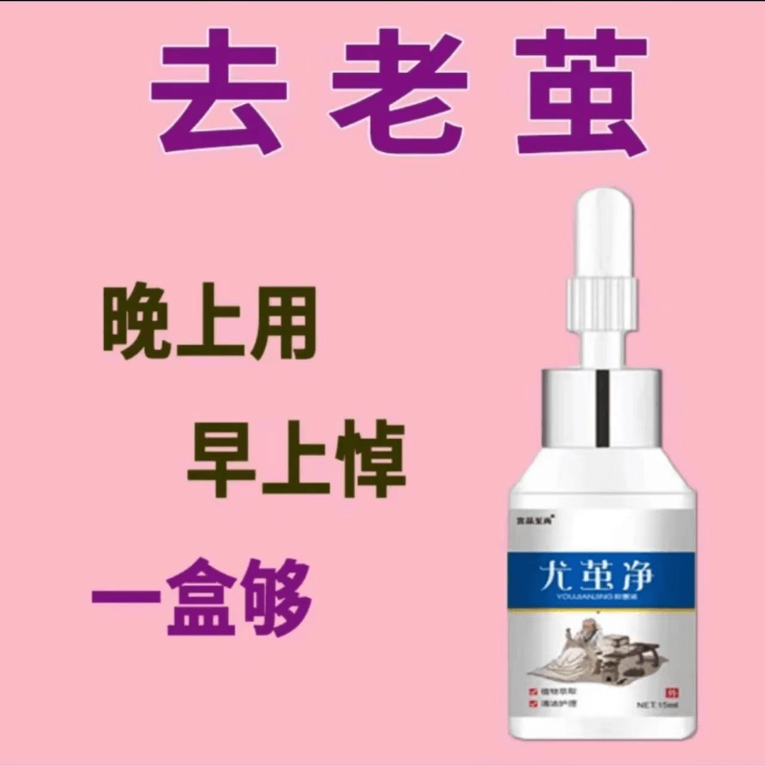 宫品至尚尤茧净老茧软化剂老茧祛除膏手茧脚茧老皮肉刺植物萃取