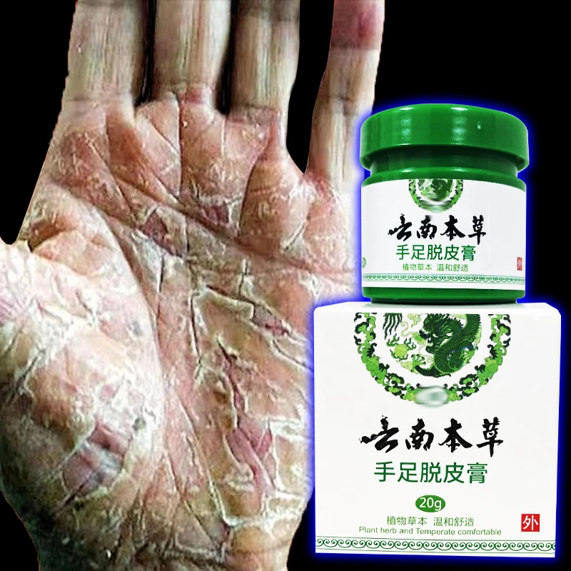 云南本草膏手足脱皮膏草本精粹外用手脚部脱皮干裂抑菌止痒干软膏