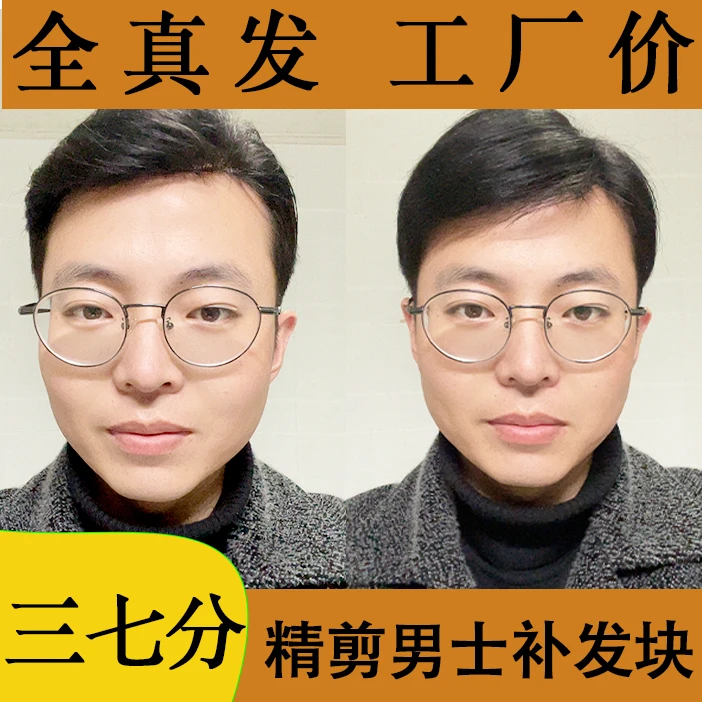 (递针款)男士补发片假发块发卡胶片两用栗子头飞机头自然款毛寸
