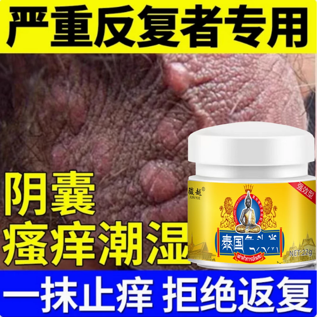 男性私处潮湿睾丸骚痒大腿两侧瘙痒皮肤瘙痒湿痒止痒抑菌乳膏外用