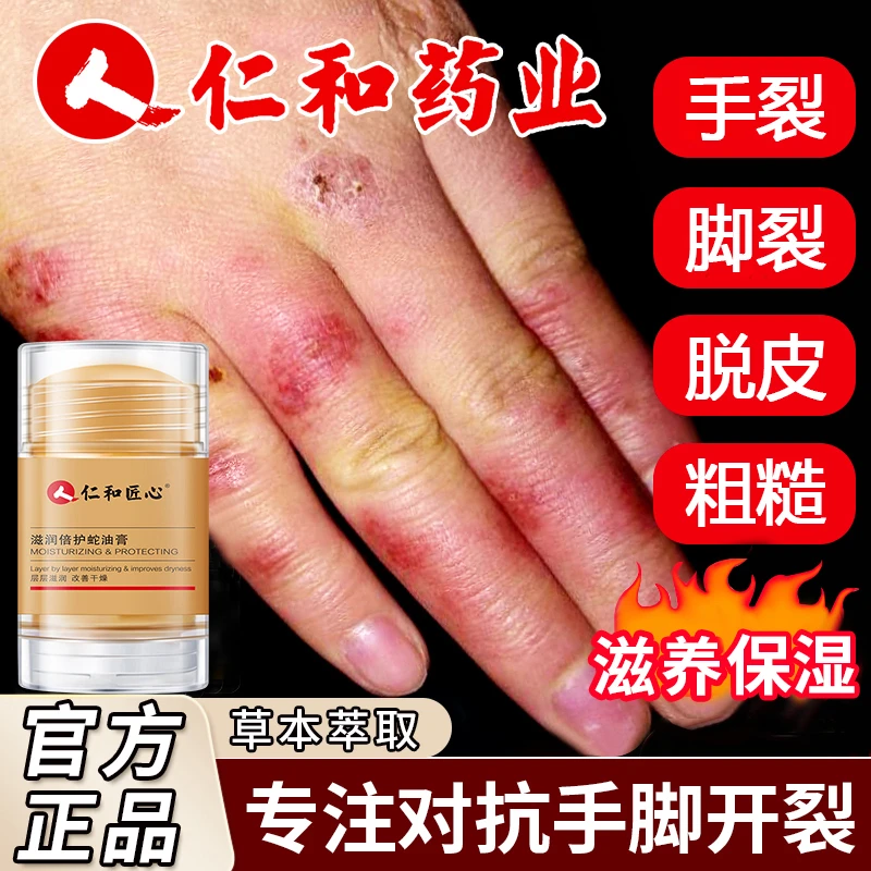 仁和蛇油膏草本霜滋润手脚防干皲裂冻裂护手霜秋冬正品滋润保湿