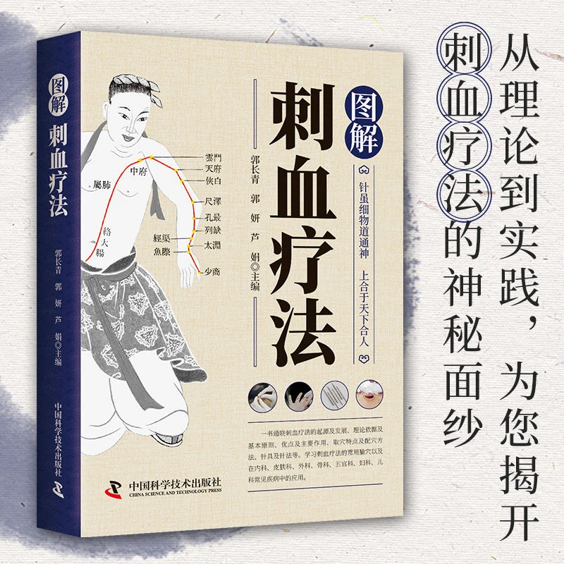 乐品学图解刺血疗法 中国刺血疗法刺血疗法治百病
