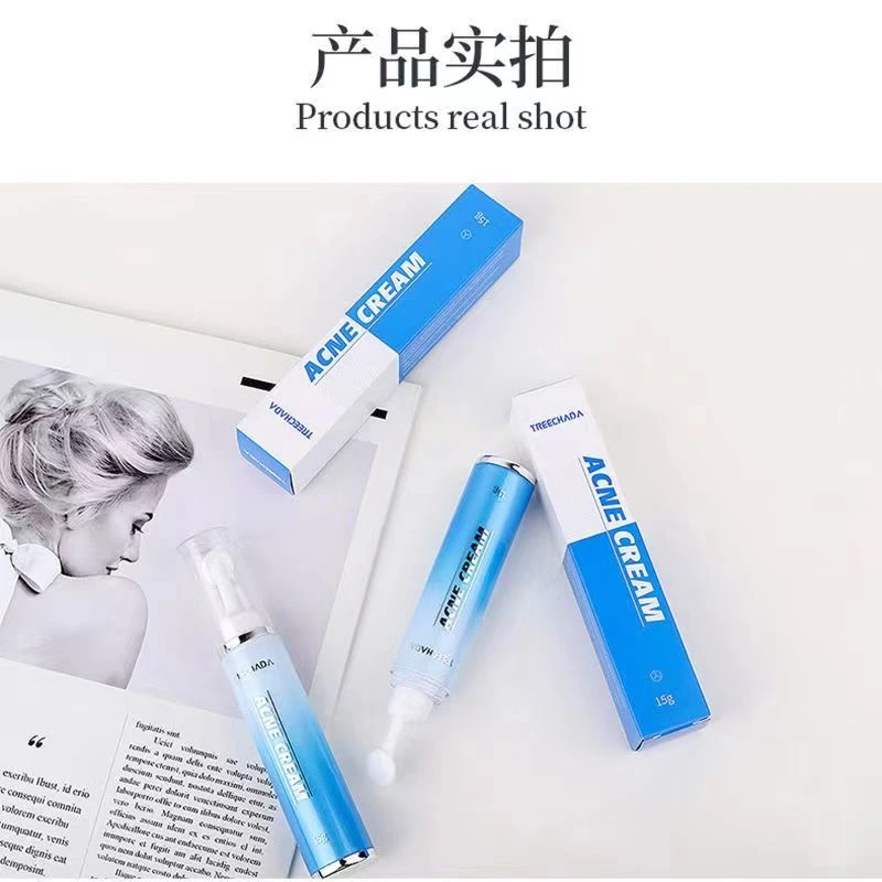 泰国进口原装璀璨达祛痘膏青春痘