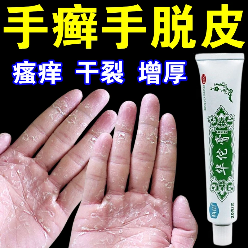 科田 华佗膏 20g 治手癣鹅掌风皮肤干裂脱皮起水泡杀菌止痒药膏