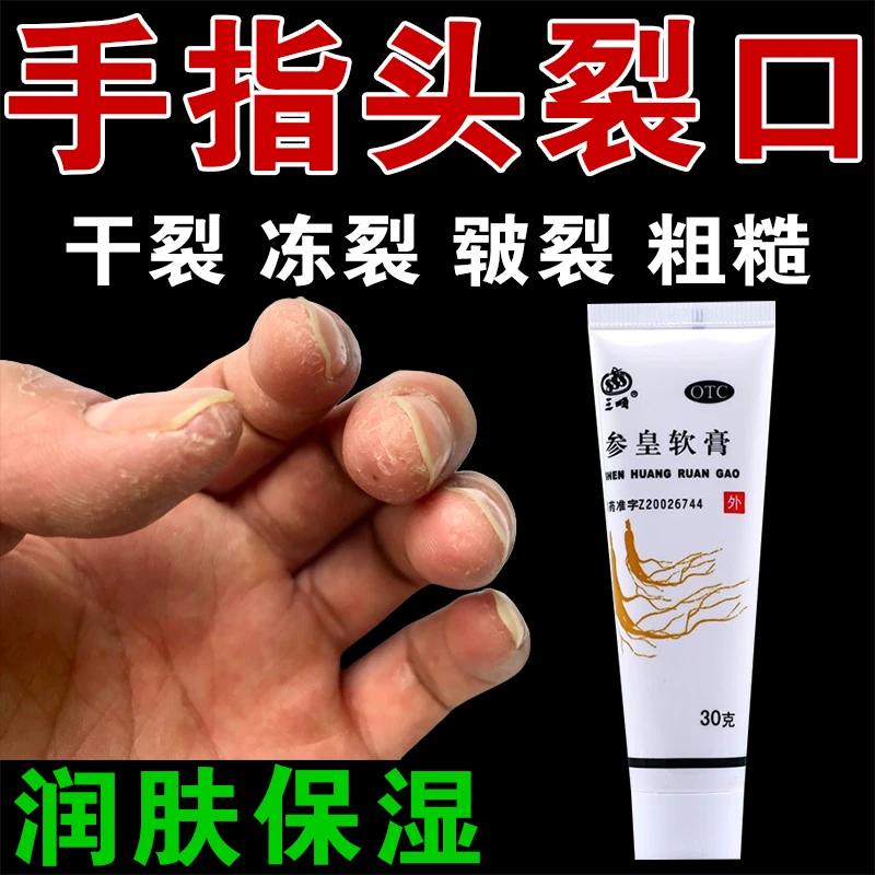 三顺手指干裂药膏治皮肤干燥手脚开裂脚后跟皲裂脱皮 参皇软膏30g