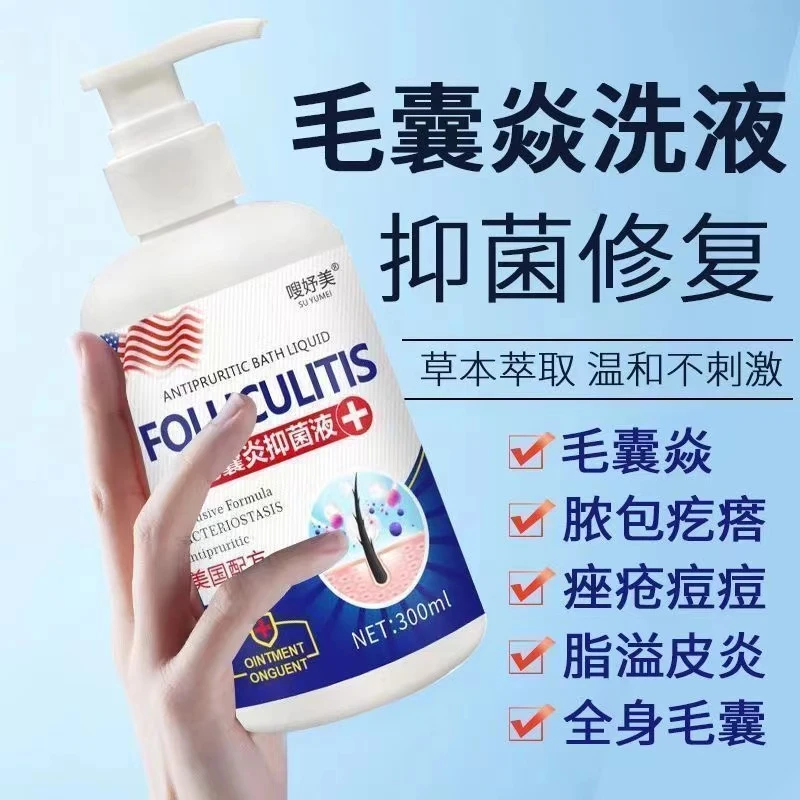 【英国大药房】毛囊炎沐浴露堵塞头上有痘痘后脑勺前胸背部胸部洗液