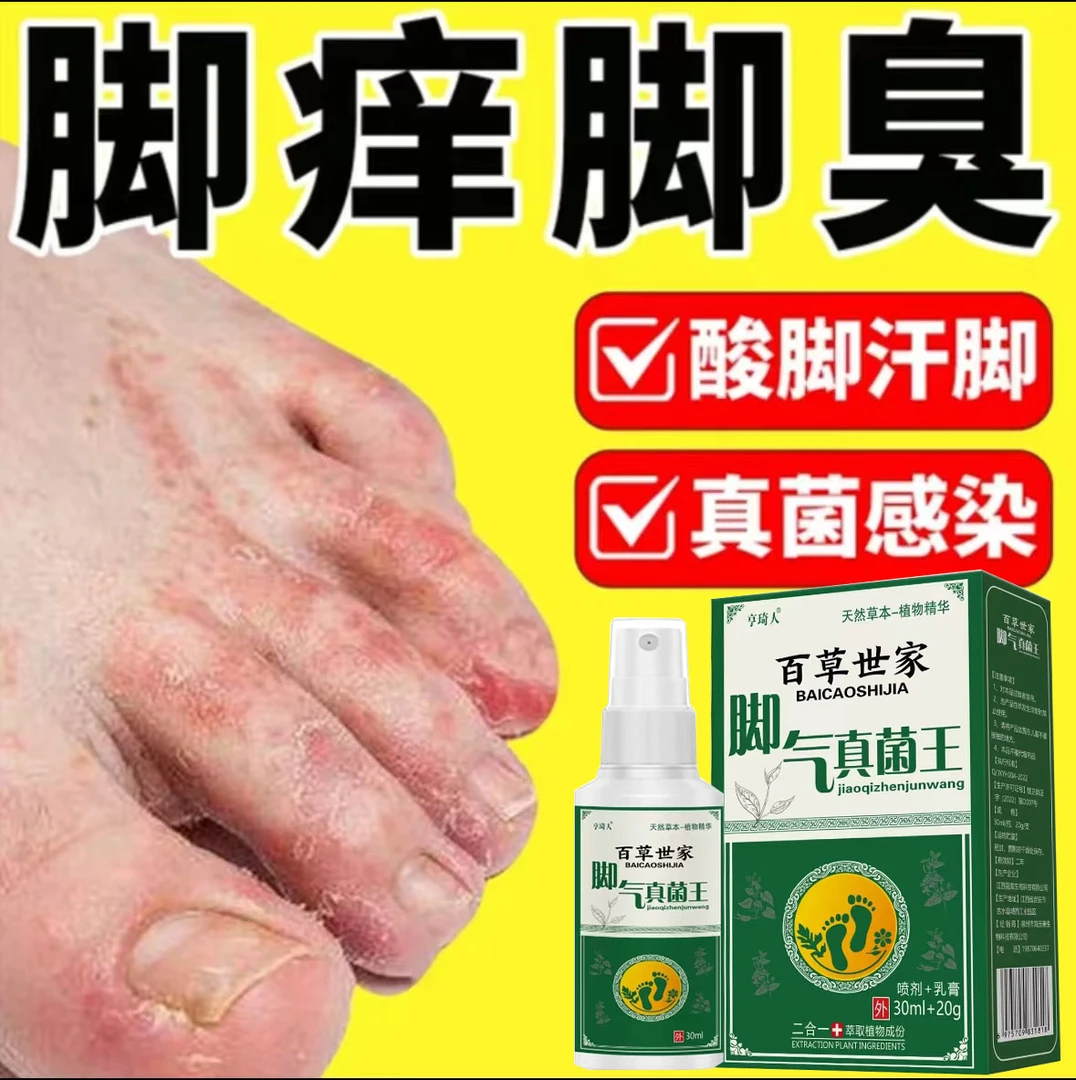 支持试用脚趾缝痒专用脚痒脚臭止痒神器脚丫脱皮抑菌开裂克星