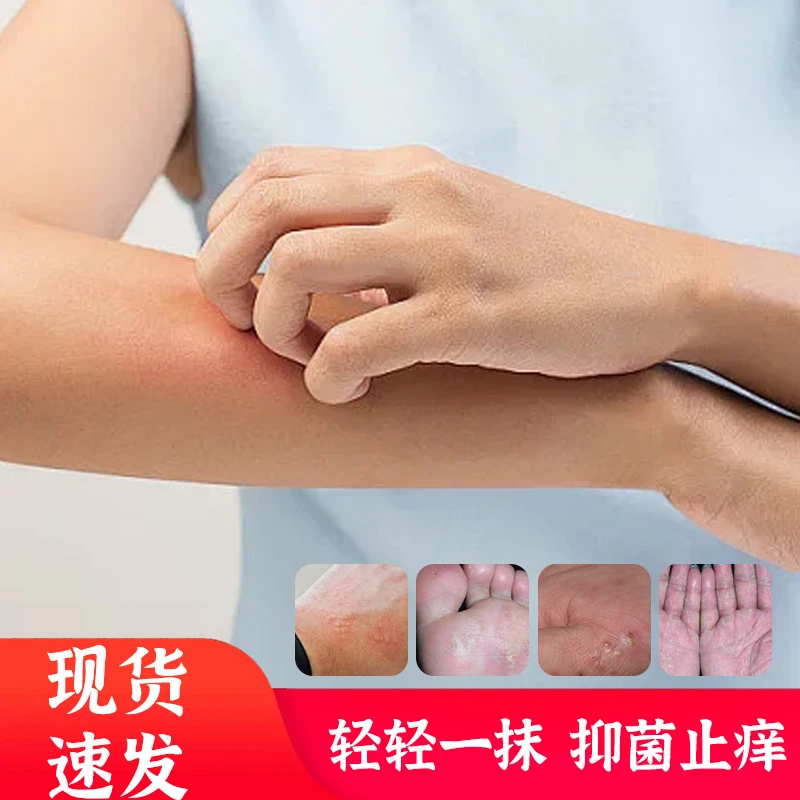 星20【拍一发二】草本萃取 温和止痒抑菌膏正品外用