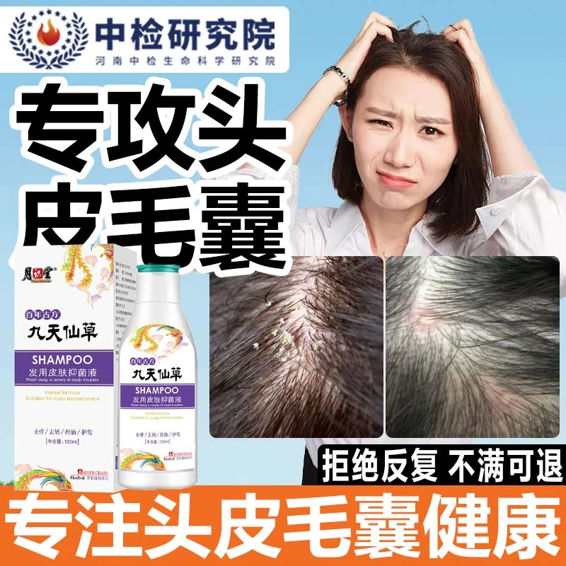毛囊膏头皮疙瘩抑菌膏前胸后背痘痘毛囊洗发水止痒克星去屑去油水