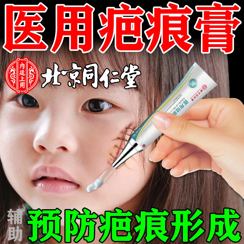 北京同仁堂疤痕膏烧伤烫伤创伤疤手术剖腹产疤痕辅助改善皮肤病理性疤痕辅助预防皮肤病理性疤痕形成内廷上用医用硅酮疤痕凝胶