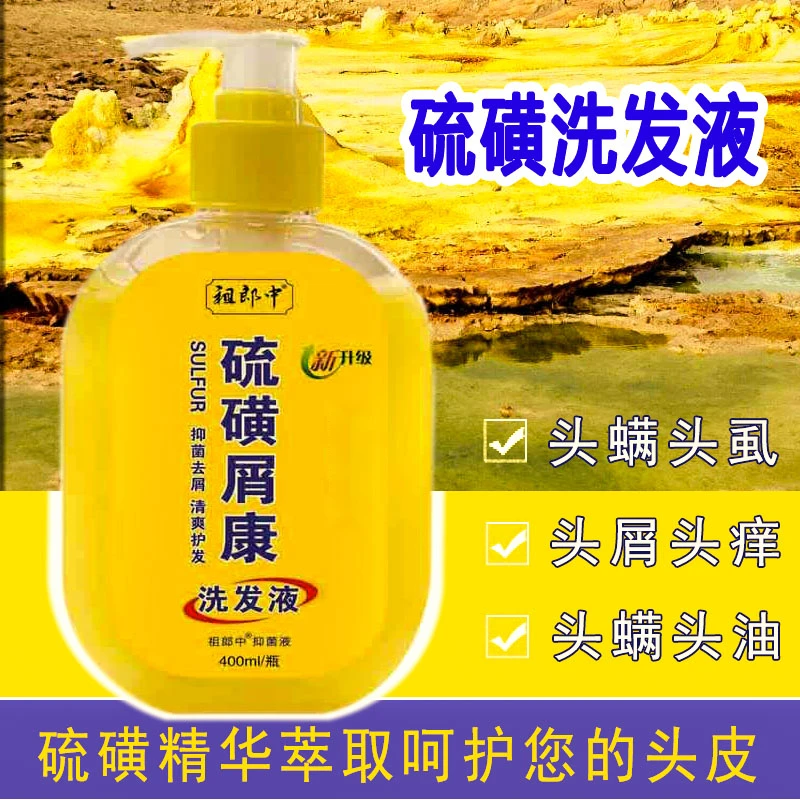 祖郎中硫磺屑康洗发液洗发水抑菌去屑控油洗发水蓬松去油头扁塌