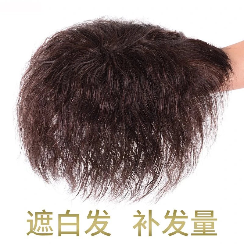 【顶盛】头顶补发片短卷发玉米烫补发块中老年妈妈假发片全真发女