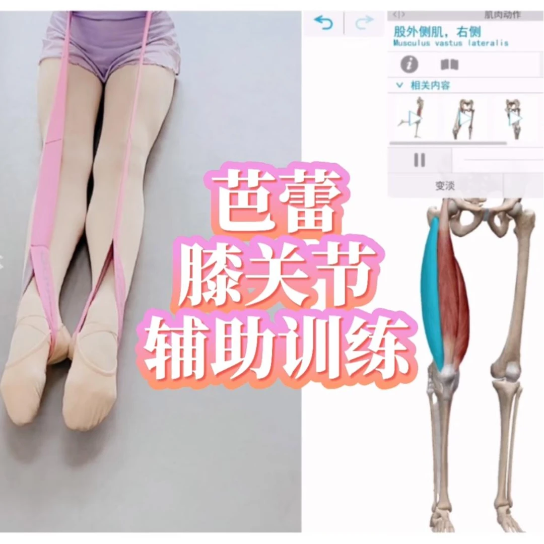 芭蕾舞蹈基本功膝关节辅助训练