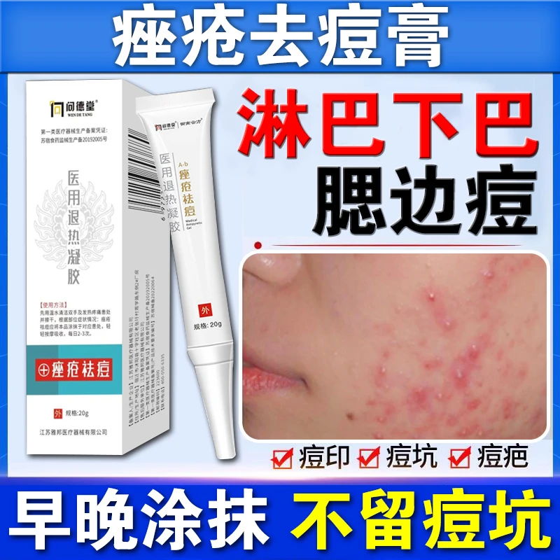 淋巴痘腮边痘去痘膏医用硬疙瘩淋巴两侧消痘坑痘印的脸上长红肿硬痘医用退热凝胶问德堂